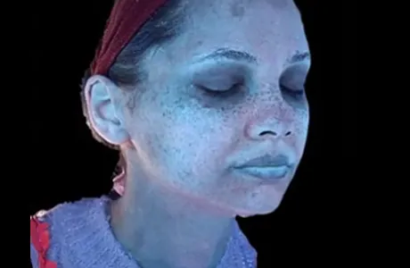 3D Meta-Vu Skin Analysis